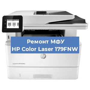 Замена лазера на МФУ HP Color Laser 179FNW в Новосибирске